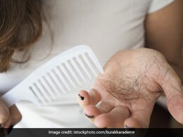 बाल झड़ने से गंजी होने लगी है खोपड़ी, तो सर्दियों में करें ये काम, रुक जाएगा Hair Fall, बढ़ने लगेगी ग्रोथ बाल झड़ने से गंजी होने लगी है खोपड़ी, तो सर्दियों में करें ये काम, रुक जाएगा Hair Fall, बढ़ने लगेगी ग्रोथ