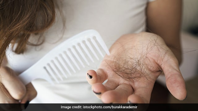 Hair loss may be caused due to hormonal changes and imbalances