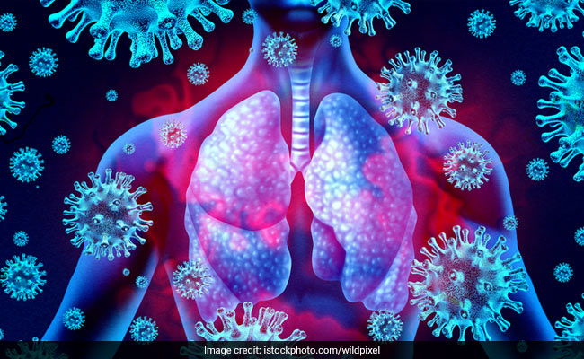 COVID-19 Can Cause Lasting Lung Damage - 3 Ways Long Covid Patients Can Suffer