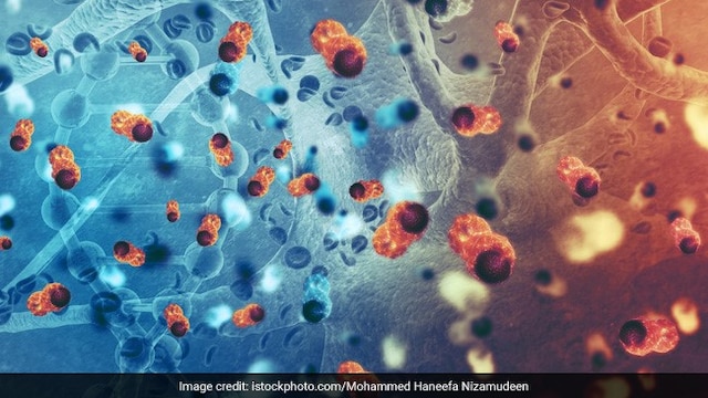 Unfortunately, pancreatic cancer has a relatively low survival rate compared to other types of cancer