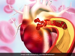 शरीर में हेल्दी SPO2 लेवल को बनाए रखने के लिए करें ये काम, आपका ब्लड सर्कुलेशन भी होगा बेहतर