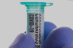COVID-19 Pandemic: What Is Herd Immunity? COVID-19 Pandemic: What Is Herd Immunity?
