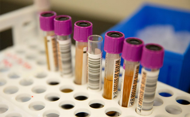 "Cellular Immunity" Lasts For 6 Months In COVID-19 Patients, Study Shows
