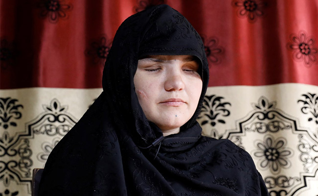 Afghan Woman Shot, Blinded, For Getting Job