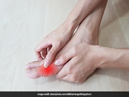 Exercise For Gout Patient: गठिया रोगियों को एक्सरसाइज बिल्कुल नहीं छोड़नी चाहिए, व्यायाम से पहले इन बातों का रखें खास ध्यान Exercise For Gout Patient: गठिया रोगियों को एक्सरसाइज बिल्कुल नहीं छोड़नी चाहिए, व्यायाम से पहले इन बातों का रखें खास ध्यान