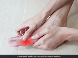 यूरिक एसिड को कम करने के लिए आज से ही खाने लगें ये चीज, कुछ ही दिनों में Uric Acid Level होगा कंट्रोल