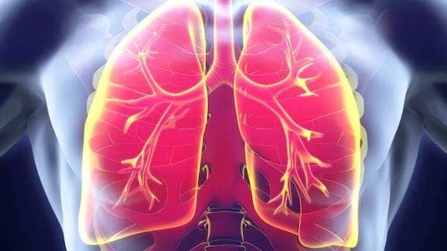 Smoking is the leading cause of lung cancer
