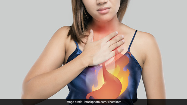 These Dietary Changes May Help Ease Heartburn And Acidity - Experts Reveal; 5 Easy Home Remedies