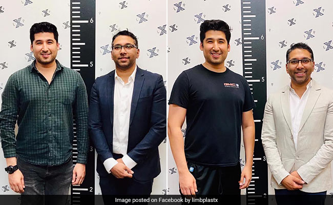 The Man Who Paid Rs 55 Lakh To Increase His Height