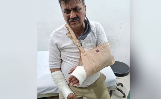 हिंसा में घायल हुए SHO ने सुनाई आपबीती, कहा-किसानों के पास थे हथियार हिंसा में घायल हुए SHO ने सुनाई आपबीती, कहा-किसानों के पास थे हथियार