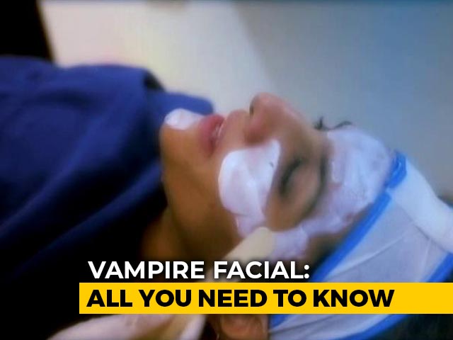 Vampire Facial And All You Need To Know