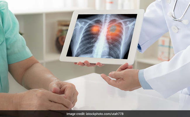 Lung Health: What Factors Influence Lung Capacity?