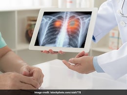 How To Detect Lung Pneumothorax At Early Stages How To Detect Lung Pneumothorax At Early Stages