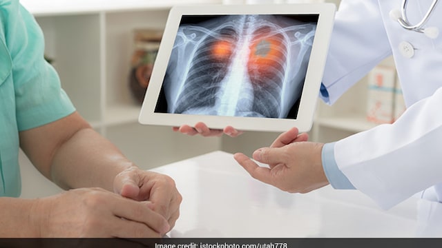 Earlier diagnosis leads to initiation of treatment at the initial stages of the disease itself