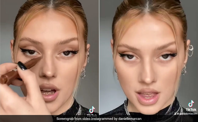 Under-Eye Dark Circles Are Trending On Social Media But It's Not To Conceal Them