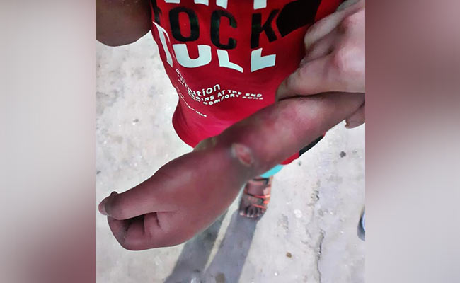 सौतेली मां ने 8 साल के बच्चे पर ढाया जुल्म, दिल्ली महिला आयोग ने आजाद कराया