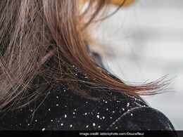 Dandruff Home Remedy: बालों से डैंड्रफ हटाने के लिए अपनाएं ये चार तरीके, बहुत जल्द दिखने लगेगा असर Dandruff Home Remedy: बालों से डैंड्रफ हटाने के लिए अपनाएं ये चार तरीके, बहुत जल्द दिखने लगेगा असर