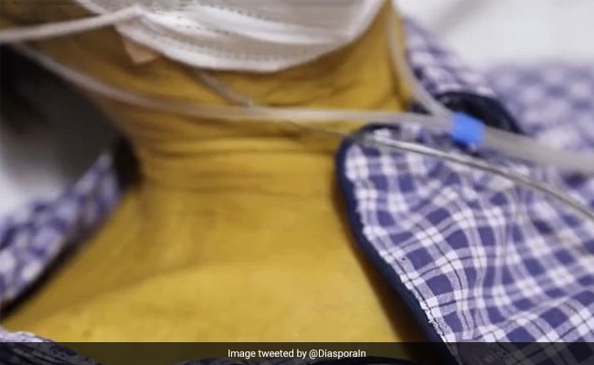 How Excessive Smoking Caused A Man's Skin To Turn Yellow
