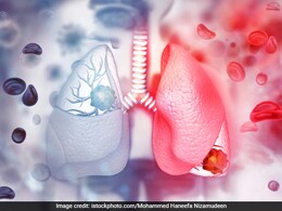 प्रदूषण से फेफड़े की सेहत हो रही है खराब तो करिए ये 2 योगासन, मिलेंगे फायदे प्रदूषण से फेफड़े की सेहत हो रही है खराब तो करिए ये 2 योगासन, मिलेंगे फायदे