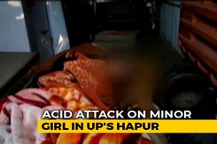 Girl Attacked With Acid In UP, Accused Arrested In 6 Hours Girl Attacked With Acid In UP, Accused Arrested In 6 Hours