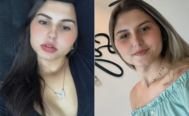 Twins Undergo Gender Confirmation Surgery Together, A First