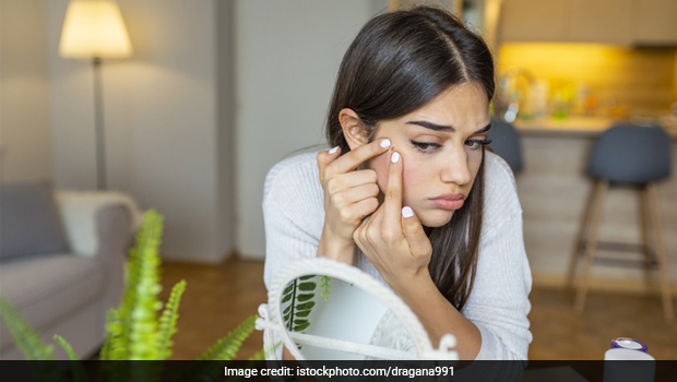 Skin Health: Celeb Nutritionist Pooja Makhija Shares 2 Easy Home Remedies To Get Rid Of Acne