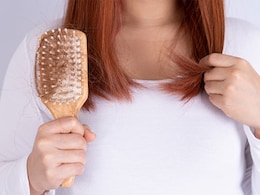 Nutritionist Discusses 3 Signs Why Your Hairfall Is Not Stopping Nutritionist Discusses 3 Signs Why Your Hairfall Is Not Stopping