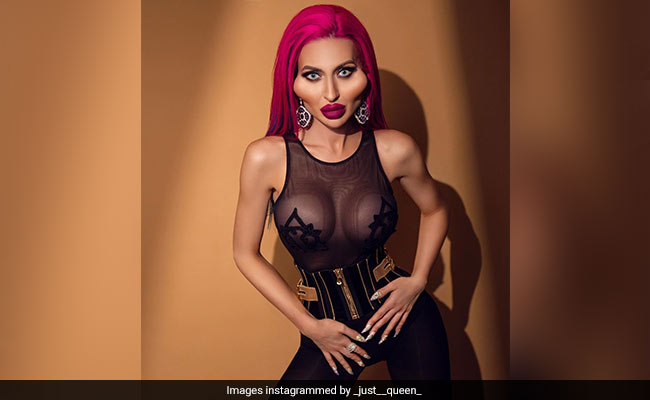 Model With 'World's Biggest Cheeks' Looks Unrecognisable In Pre-Surgery Pics