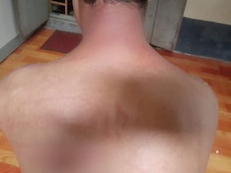 3 Hours In "Hell Room": Myanmar Protester Describes Beating In Custody 3 Hours In "Hell Room": Myanmar Protester Describes Beating In Custody