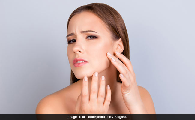 Beauty Tips To Deal With Oily Skin And Avoid Acne For A Natural Glow