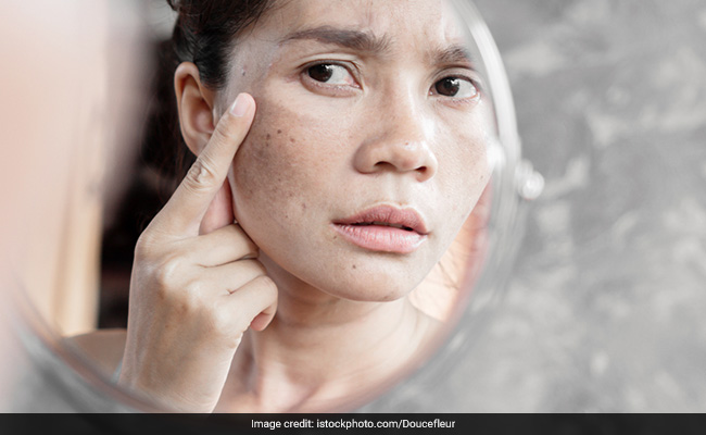 Here's How You Can Fight Pigmentation And Improve Skin Health: Expert Tips