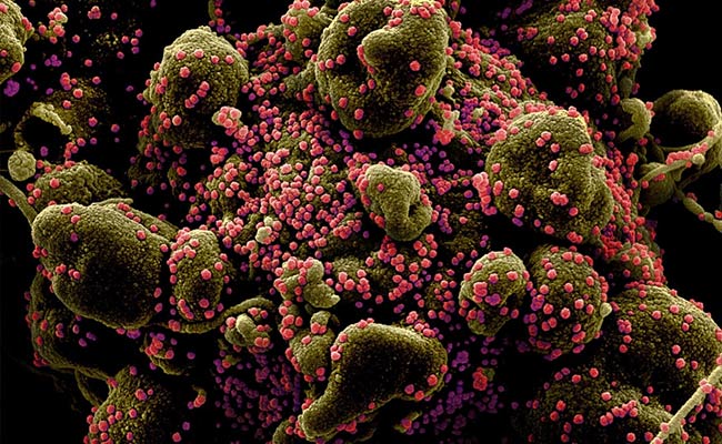 UK Covid Variant Not Linked To More Serious Infections: Study