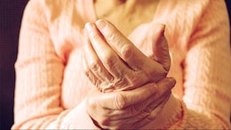 Can You Have Osteoporosis Without Knowing It? Myths About Symptoms, Bone Density And Diagnosis