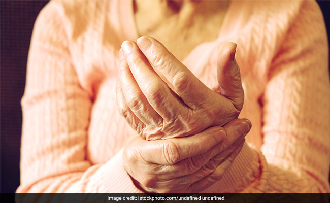 Osteoarthritis is often associated with ageing