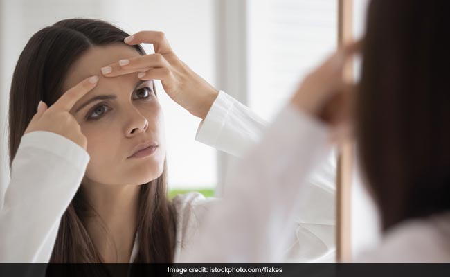 What Causes Open Pores? Effective Home Remedies To Tighten The Pores