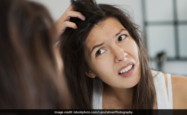 Get Rid Of Oily And Itchy Scalp With These Amazing DIY Scrubs