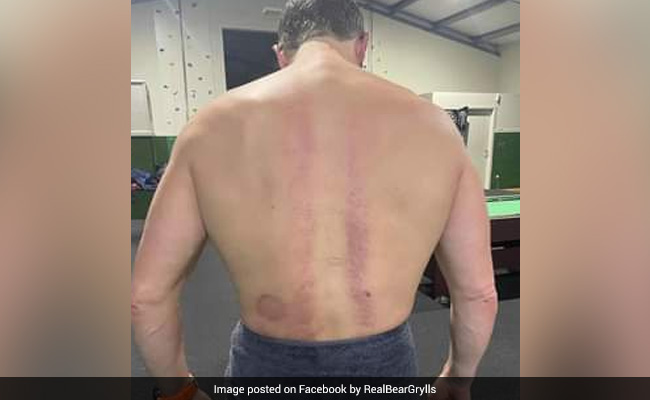 Bear Grylls Opens Up On Parachuting Accident That Changed His Life