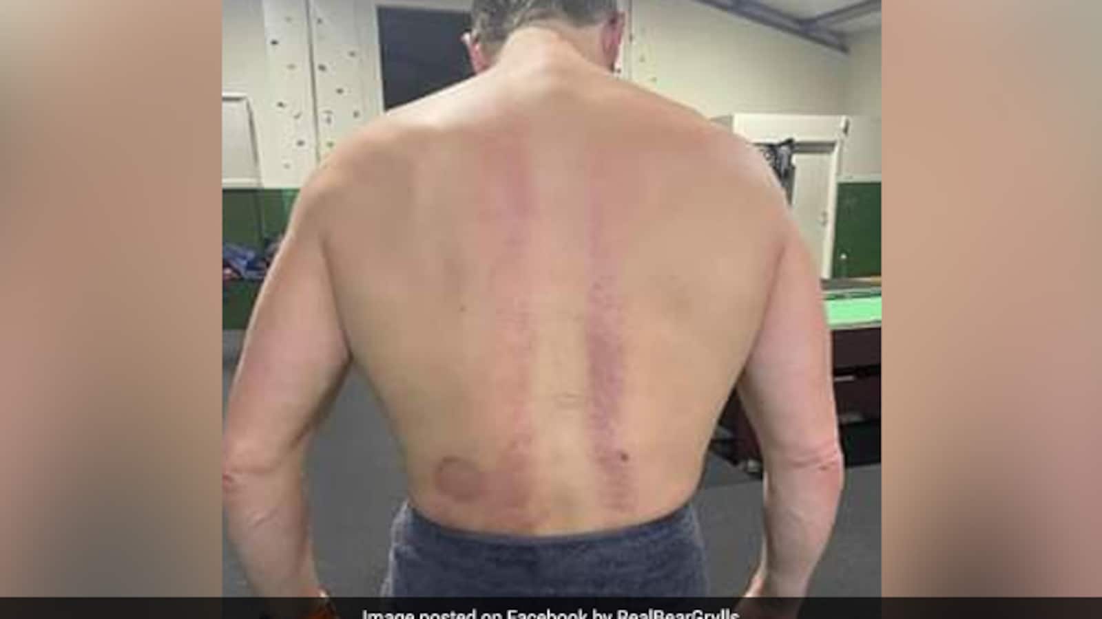 Bear Grylls Opens Up On Parachuting Accident That Changed His Life