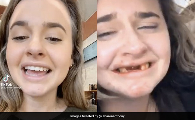 Shocking! Girl Loses Front Teeth After Too Many Mimosa Drinks; Watch Viral Video