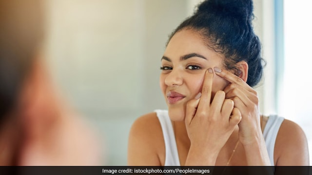 Hormonal imbalance can lead to several issues including acne