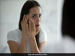 Summer Skincare: Home Remedies For Black Marks On Face Summer Skincare: Home Remedies For Black Marks On Face