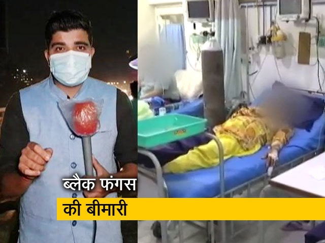 सिटी एक्सप्रेस : कोरोना मरीजों में ब्लैक फंगस का बढ़ता खतरा