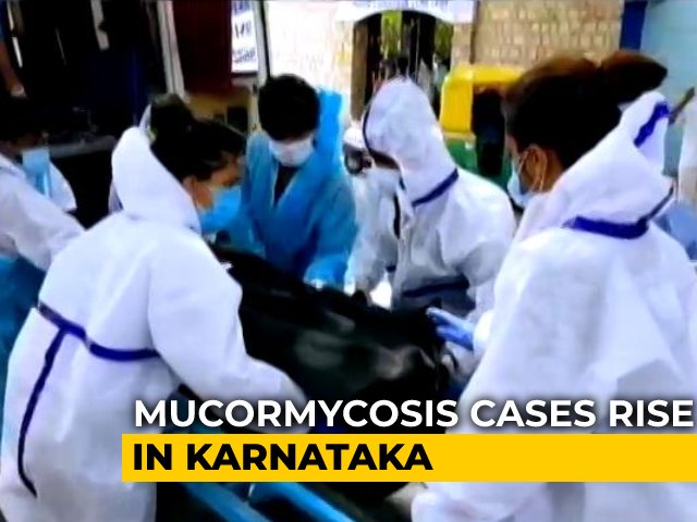 "Epidemic Within Pandemic": Karnataka Changes Steps To Fight Black Fungus
