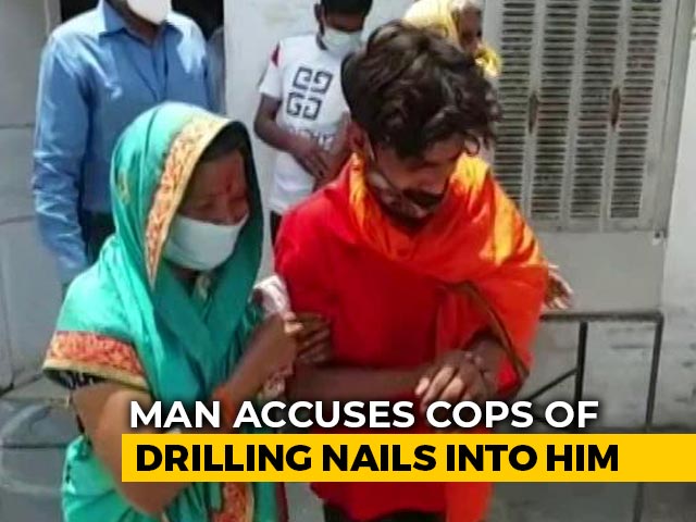 "Baseless": UP Police As Man Claims They Drilled Nails In His Hand, Foot