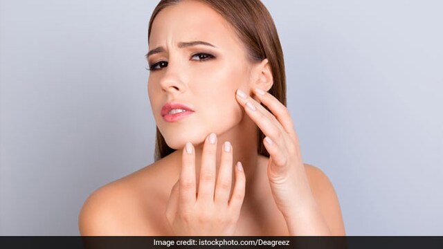 Skincare tips: Keep your skin moisturised to avoid cracking