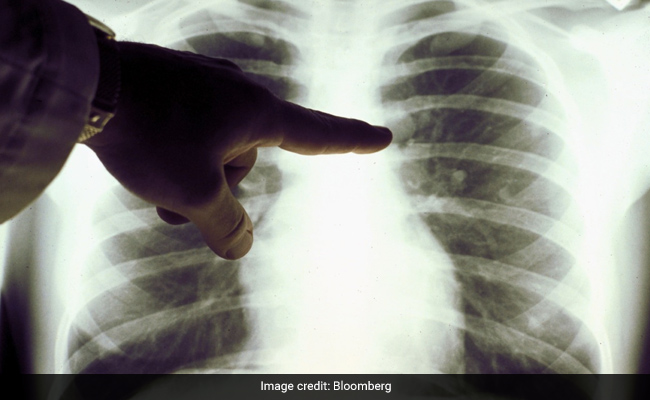 Vaccine Best Weapon Against Covid And Its Secondary Effects