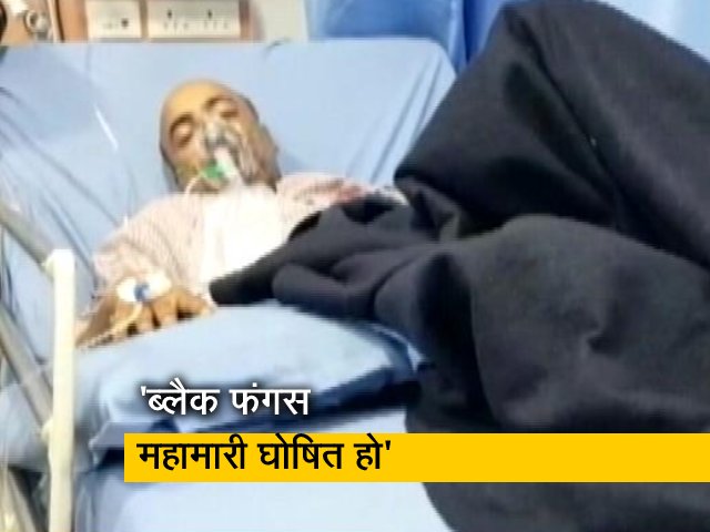 Videos : ब्लैक फंगस को लेकर केंद्र का राज्य सरकारों को निर्देश