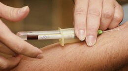 In A First, Alzheimer's Blood Test Available in US From June