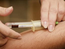 In A First, Alzheimer's Blood Test Available in US From June In A First, Alzheimer's Blood Test Available in US From June