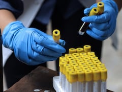 Your Age May Influence Antibody Production In Response To A Virus: Study